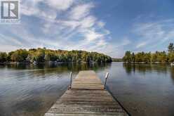 1054 THE NARROWS TRAIL | Minden Hills Ontario | Slide Image Thirty-four