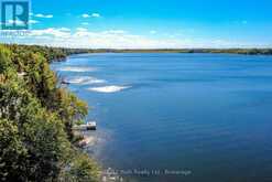 222 LAKE DALRYMPLE ROAD | Ramara Ontario | Slide Image Thirty