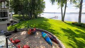 3909 TREELINE DRIVE | Washago Ontario | Slide Image Thirty-seven