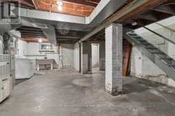 55 SNOWDON AVENUE | Toronto Ontario | Slide Image Forty-five